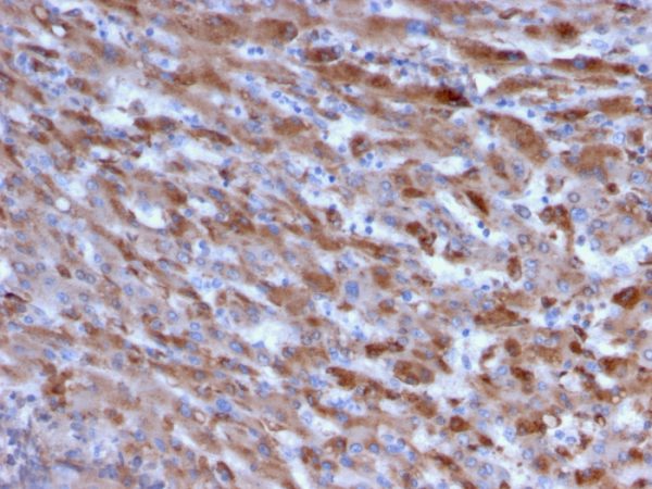 Formalin-fixed, paraffin-embedded human Liver stained with C1QA Mouse Monoclonal Antibody (C1QA/2955).