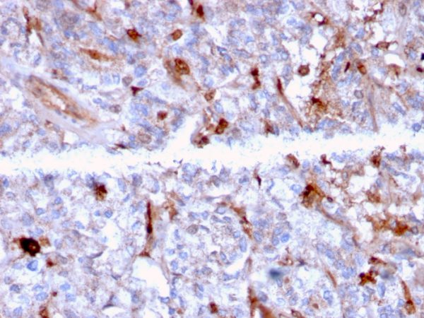 Formalin-fixed, paraffin-embedded human Kidney stained with C1QA Mouse Monoclonal Antibody (C1QA/2956).