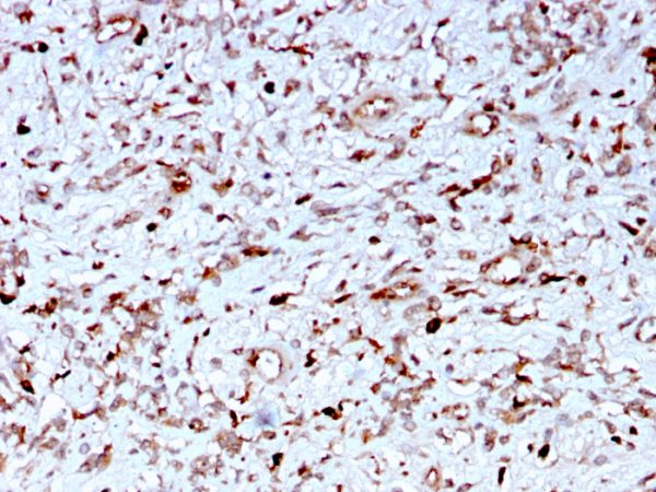 Formalin-fixed, paraffin-embedded human Liver stained with C1QA Mouse Monoclonal Antibody (C1QA/2956).