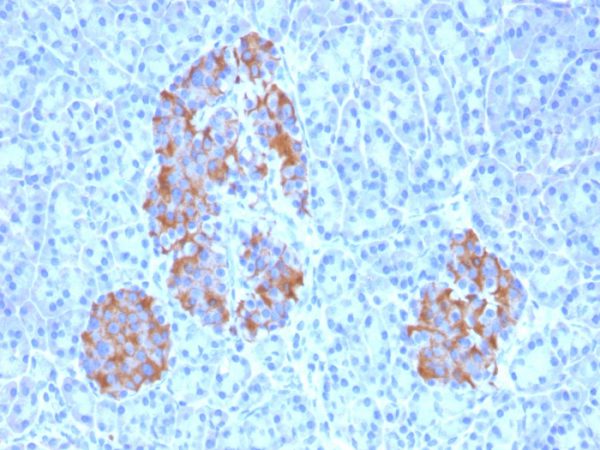 Formalin-fixed, paraffin-embedded human Pancreas stained with TNF alpha Mouse Monoclonal Antibody (TNFA/1172).