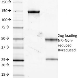 SDS-PAGE Analysis of Purified TNF-alpha Mouse Monoclonal Antibody (J2D10). Confirmation of Purity and Integrity of Antibody.