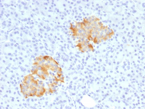 Formalin-fixed, paraffin-embedded human Pancreas stained with TNF alpha Rabbit Polyclonal Antibody.