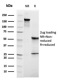 SDS-PAGE Analysis of Purified C1QB Mouse Monoclonal Antibody (C1QB/2961). Confirmation of Purity and Integrity of Antibody. C1QB / Complement C1q B-Chain Antibody - Image 2