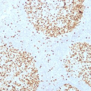 Formalin-fixed, paraffin-embedded human Tonsil stained with Topoisomerase II alpha Monoclonal Antibody (TOP2A/1361).