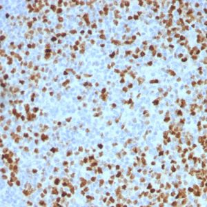 Formalin-fixed, paraffin-embedded human Tonsil stained with Topoisomerase II alpha Monoclonal Antibody (TOP2A/1362).