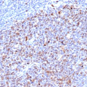 Formalin-fixed, paraffin-embedded human tonsil stained with Topo II alpha Recombinant Mouse Monoclonal Antibody (rTOP2A/6629).