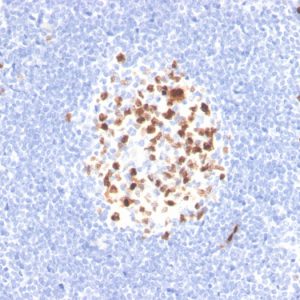 Formalin-fixed, paraffin-embedded human lymph node stained with Topo IIa Recombinant Rabbit Monoclonal Antibody (TOP2A/4397R).