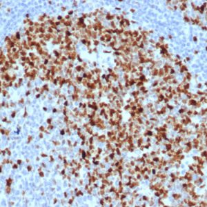 Formalin-fixed, paraffin-embedded human tonsil stained with Topo IIa Recombinant Rabbit Monoclonal Antibody (TOP2A/6570R).