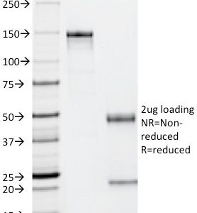 SDS-PAGE Analysis of Purified p53 Mouse Monoclonal Antibody (PAb122). Confirmation of Purity and Integrity of Antibody.