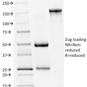 SDS-PAGE Analysis of Purified p53 Mouse Monoclonal Antibody (PAb240). Confirmation of Integrity and Purity of Antibody.
