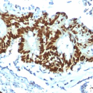 Formalin-fixed, paraffin-embedded human tonsil stained with p53 Recombinant Rabbit Monoclonal Antibody (TP53/1799R).