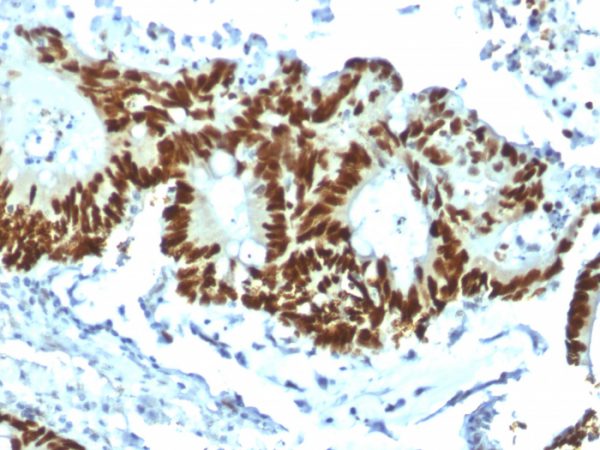 Formalin-fixed, paraffin-embedded human tonsil stained with p53 Recombinant Rabbit Monoclonal Antibody (TP53/1799R).