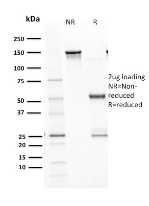 SDS-PAGE Analysis  Purified p53 Recombinant Rabbit Monoclonal Antibody (TP53/1799R). Confirmation of Purity and Integrity of Antibody.