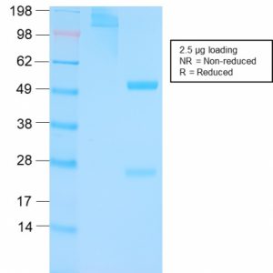 SDS-PAGE Analysis of Purified p53 Rabbit Recombinant Monoclonal Antibody (TP53/3156R). Confirmation of Purity and Integrity of Antibody.