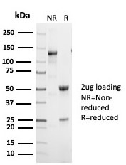 SDS-PAGE Analysis of Purified p53 Recombinant Rabbit Monoclonal Antibody (TP53/7002R). Confirmation of Purity and Integrity of Antibody.