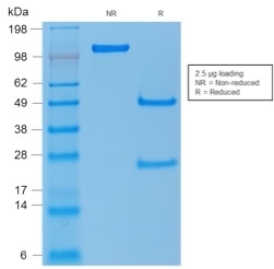 SDS-PAGE Analysis of Purified p53 Rabbit Polyclonal Antibody. Confirmation of Purity and Integrity of Antibody.