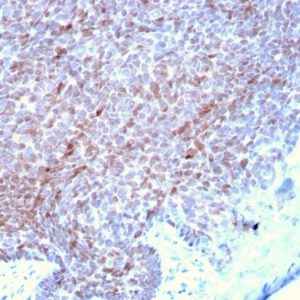 Formalin-fixed, paraffin-embedded human Skin stained with p73 Mouse Monoclonal Antibody (P73/2531).