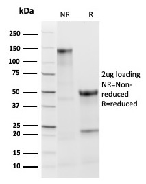 SDS-PAGE Analysis of Purified TPO Recombinant Rabbit Monoclonal Antibody (TPO/3813R). Confirmation of Integrity and Purity of the Antibody.
