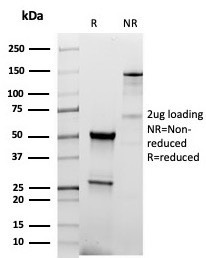 SDS-PAGE Analysis Thyroid Peroxidase Recombinant Rabbit Monoclonal Antibody (TPO/6417R). Confirmation of Purity and Integrity of Antibody.