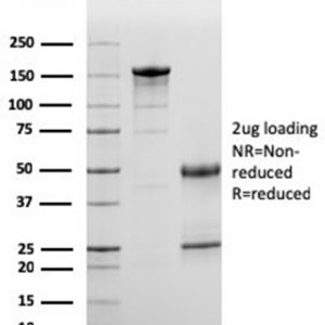 SDS-PAGE Analysis of Purified Complement 3d Mouse Monoclonal Antibody (C3D/2891). Confirmation of Integrity and Purity of Antibody.