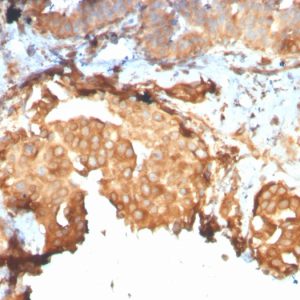 Recombinant GRP94 / HSP90B1 (Endoplasmic Reticulum Marker) Antibody