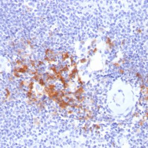 Formalin-fixed, paraffin-embedded human Spleen stained with TRAF1 Mouse Monoclonal Antibody (TRAF1/2770).