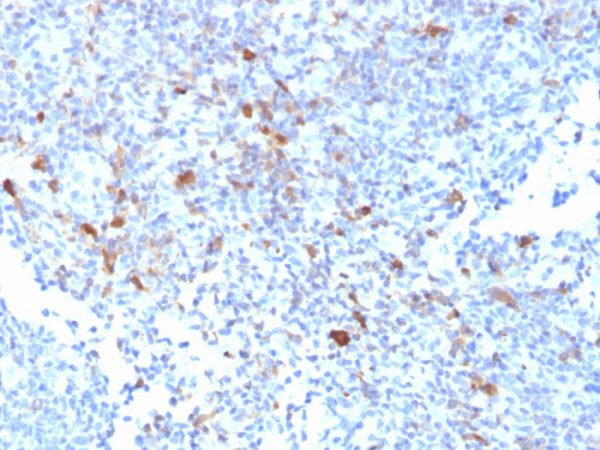 Formalin-fixed, paraffin-embedded human Lymph Node stained with TRAF1 Mouse Monoclonal Antibody (TRAF1/2770).
