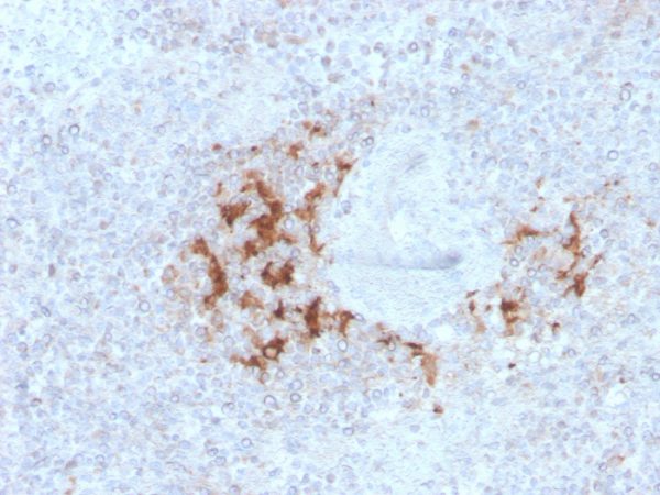 Formalin-fixed, paraffin-embedded human Spleen stained with TRAF1 Mouse Monoclonal Antibody (TRAF1/3298).