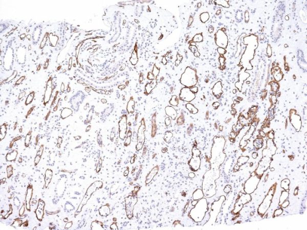 Formalin-fixed, paraffin-embedded human Kidney Transplant stained with Complement 4d Mouse Monoclonal Antibody (C4D204).