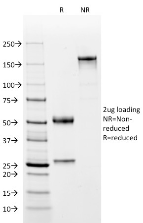 SDS-PAGE Analysis Purified Complement 4d Mouse Monoclonal Antibody (C4D204). Confirmation of Integrity and Purity of Antibody.
