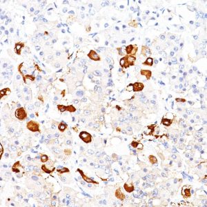Formalin-fixed, paraffin-embedded human pituitary stained with TSH beta Mouse Monoclonal Antibody (TSHb/1317).