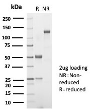 SDS-PAGE Analysis of Purified TSH beta Rabbit Monoclonal Antibody (TSHb/7001R). Confirmation of Purity and Integrity of Antibody.