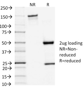 SDS-PAGE Analysis of Purified TSH-Receptor, A-Chain Mouse Monoclonal Antibody (TSHRA/1402). Confirmation of Purity and Integrity of Antibody.