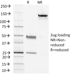SDS-PAGE Analysis of Purified TSHRB Monoclonal Antibody (TSHRB/1405). Confirmation of Purity and Integrity of Antibody.
