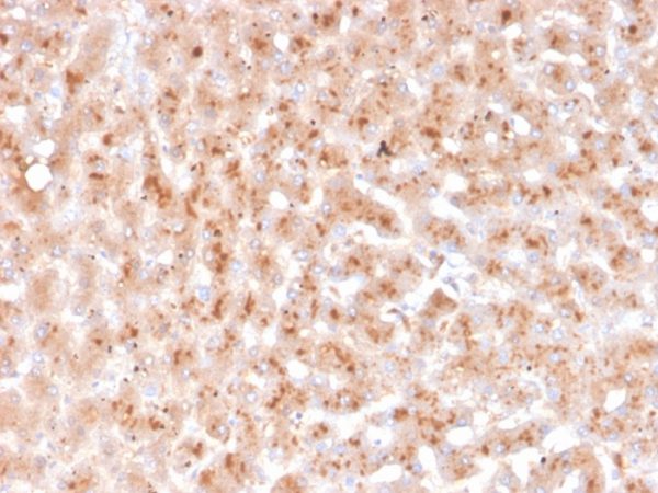 Formalin-fixed, paraffin-embedded human liver stained with Transthyretin Mouse Monoclonal Antibody (TTR/4292).
