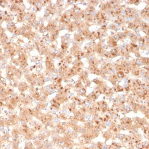 Formalin-fixed, paraffin-embedded human liver stained with Transthyretin Mouse Monoclonal Antibody (TTR/4293).