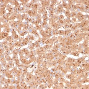 Formalin-fixed, paraffin-embedded human liver stained with Transthyretin Mouse Monoclonal Antibody (TTR/4295).