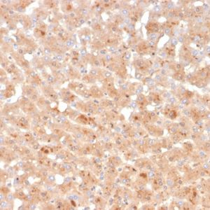 Formalin-fixed, paraffin-embedded human liver stained with Transthyretin Mouse Monoclonal Antibody (TTR/4296).