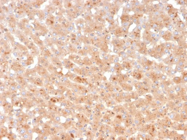 Formalin-fixed, paraffin-embedded human liver stained with Transthyretin Mouse Monoclonal Antibody (TTR/4296).