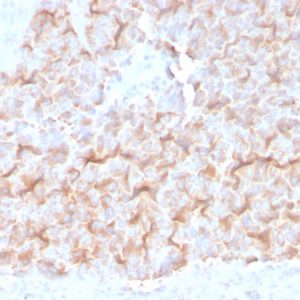 Formalin-fixed, paraffin-embedded human Lung stained with Tubulin alpha Mouse Monoclonal Antibody (TUBA/3038).