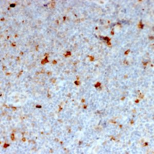 Formalin-fixed, paraffin-embedded human lymph node stained with OX40 Mouse Monoclonal Antibody (OX40/2721).