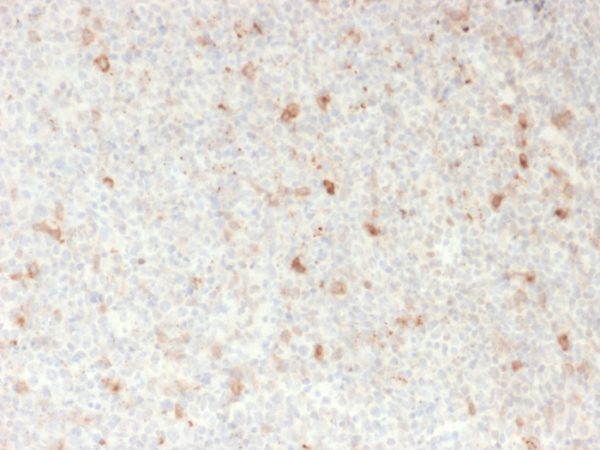 Formalin-fixed, paraffin-embedded human lymph node stained with OX40 Mouse Monoclonal Antibody (OX40/2721).