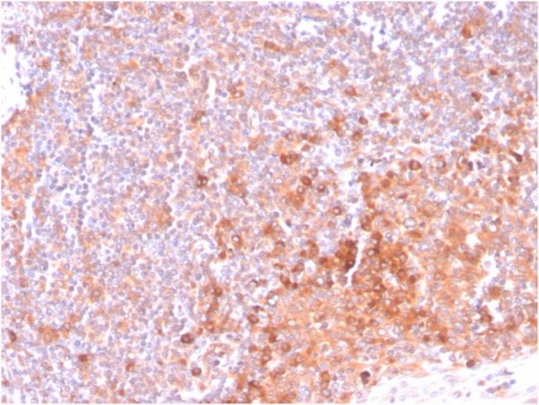 Formalin-fixed, paraffin-embedded human Tonsil stained with OX40 Mouse Monoclonal Antibody (OX40/3108).