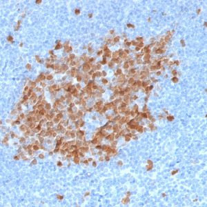 Formalin-fixed, paraffin-embedded human Tonsil stained with Thymidylate Synthase Mouse Monoclonal Antibody (TYMS/1884).
