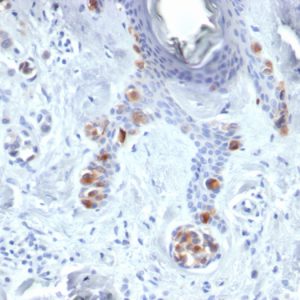 Formalin-fixed, paraffin-embedded human skin stained with Tyrosinase Mouse Monoclonal Antibody (TYR/3829).