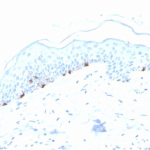 Formalin-fixed, paraffin-embedded human Skin stained with TYRP1-Monospecific Mouse Monoclonal Antibody (TYRP1/3280).