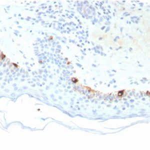 Formalin-fixed, paraffin-embedded human Skin stained with TYRP1-Monospecific Mouse Monoclonal Antibody (TYRP1/3281).