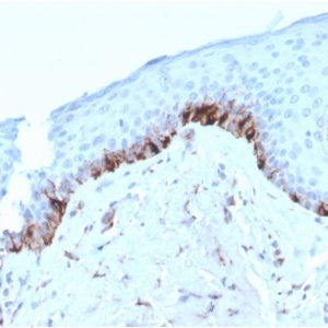 Formalin-fixed, paraffin-embedded human Skin stained with TYRP1-Monospecific Mouse Monoclonal Antibody (TYRP1/3282).
