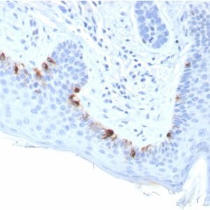 Formalin-fixed, paraffin-embedded human Skin stained with TYRP1-Monospecific Mouse Monoclonal Antibody (TYRP1/3283).