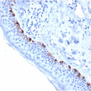 Formalin-fixed, paraffin-embedded human Skin stained with TYRP1-Monospecific Mouse Monoclonal Antibody (TYRP1/3284).